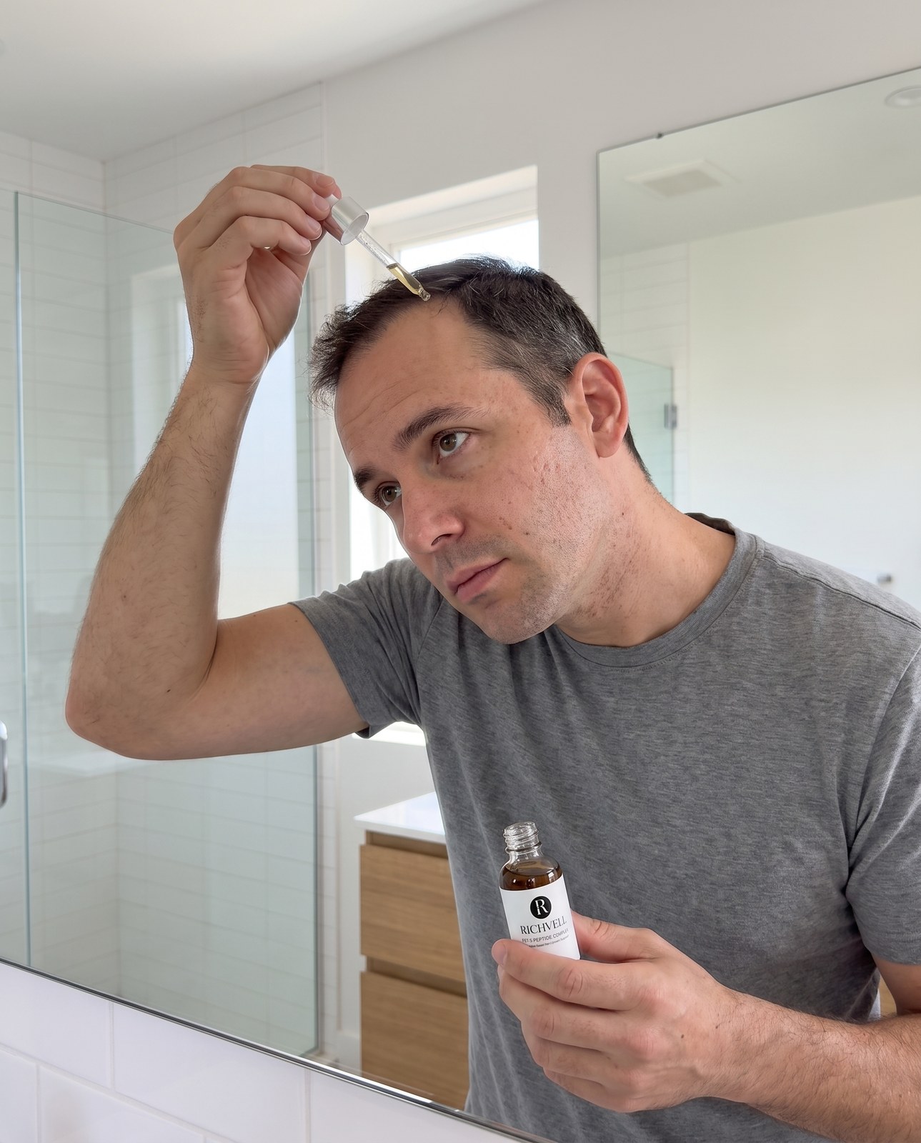 Man applying FST-5 to his hairline